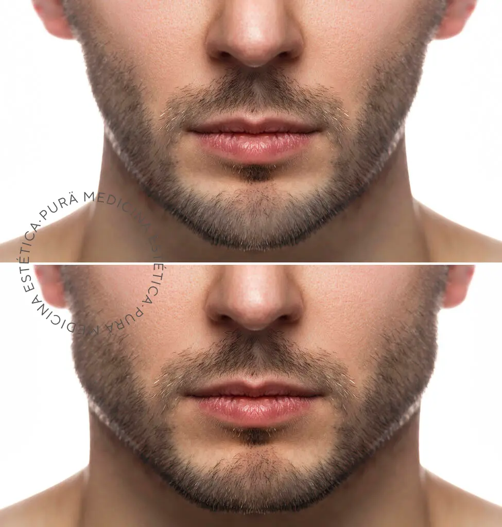 Natural results without surgery