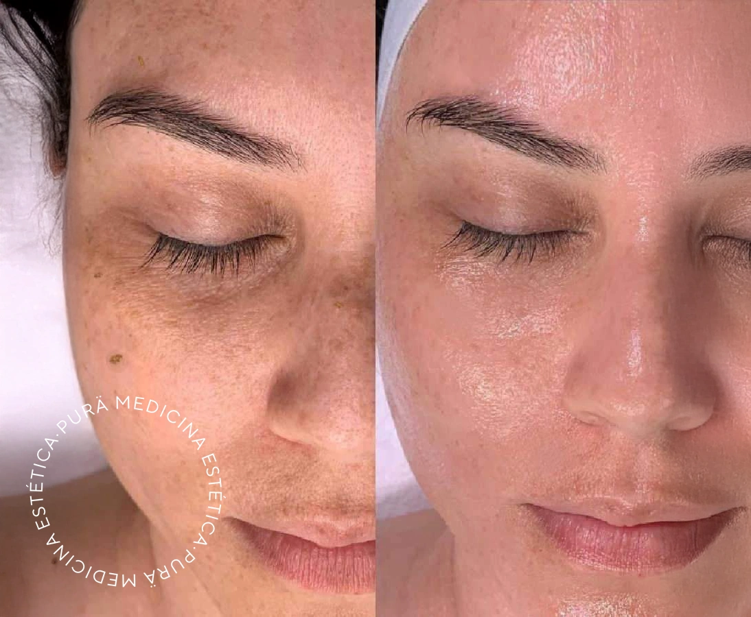Patient results Before and after the immediate glow up