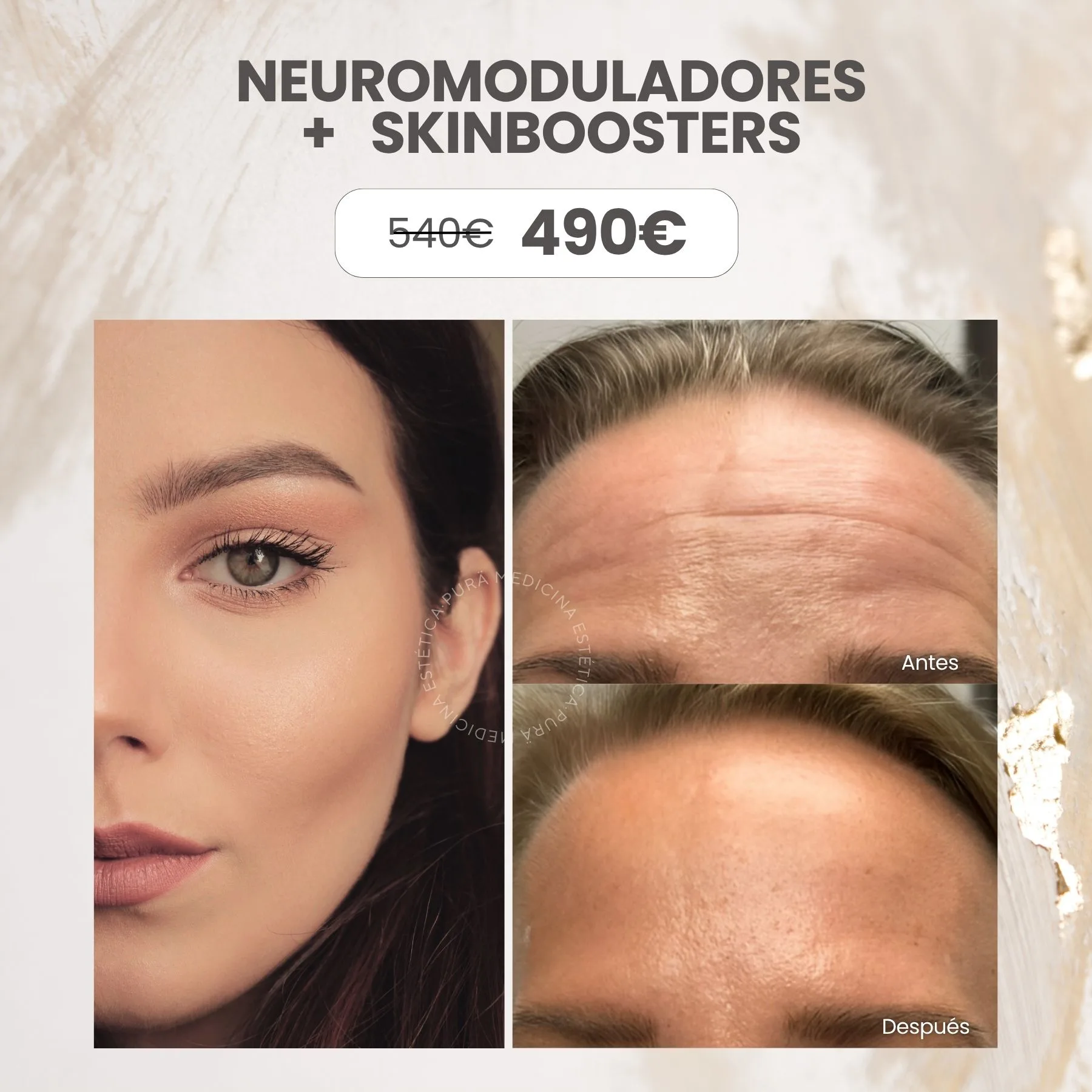 neuromoduladores-skinboosters
