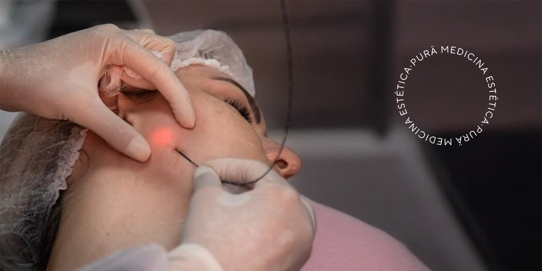 Cuidados después del endolift facial