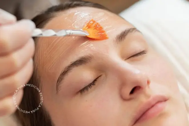 Carboxiterapia